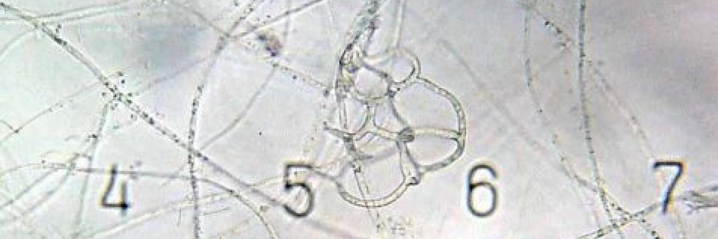 Het mycelium of de zwamvlok